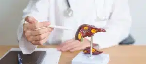 fettleber erklaerung arzt norsan omega-3