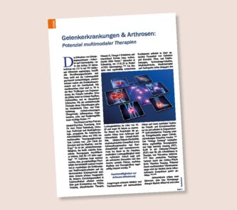 Fachartikel: Gelenkerkrankungen und Arthrosen