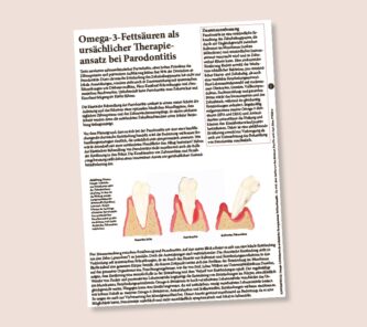 Fachartikel: Omega-3-Fettsäuren als ursächlicher Therapieansatz bei Parodontitis